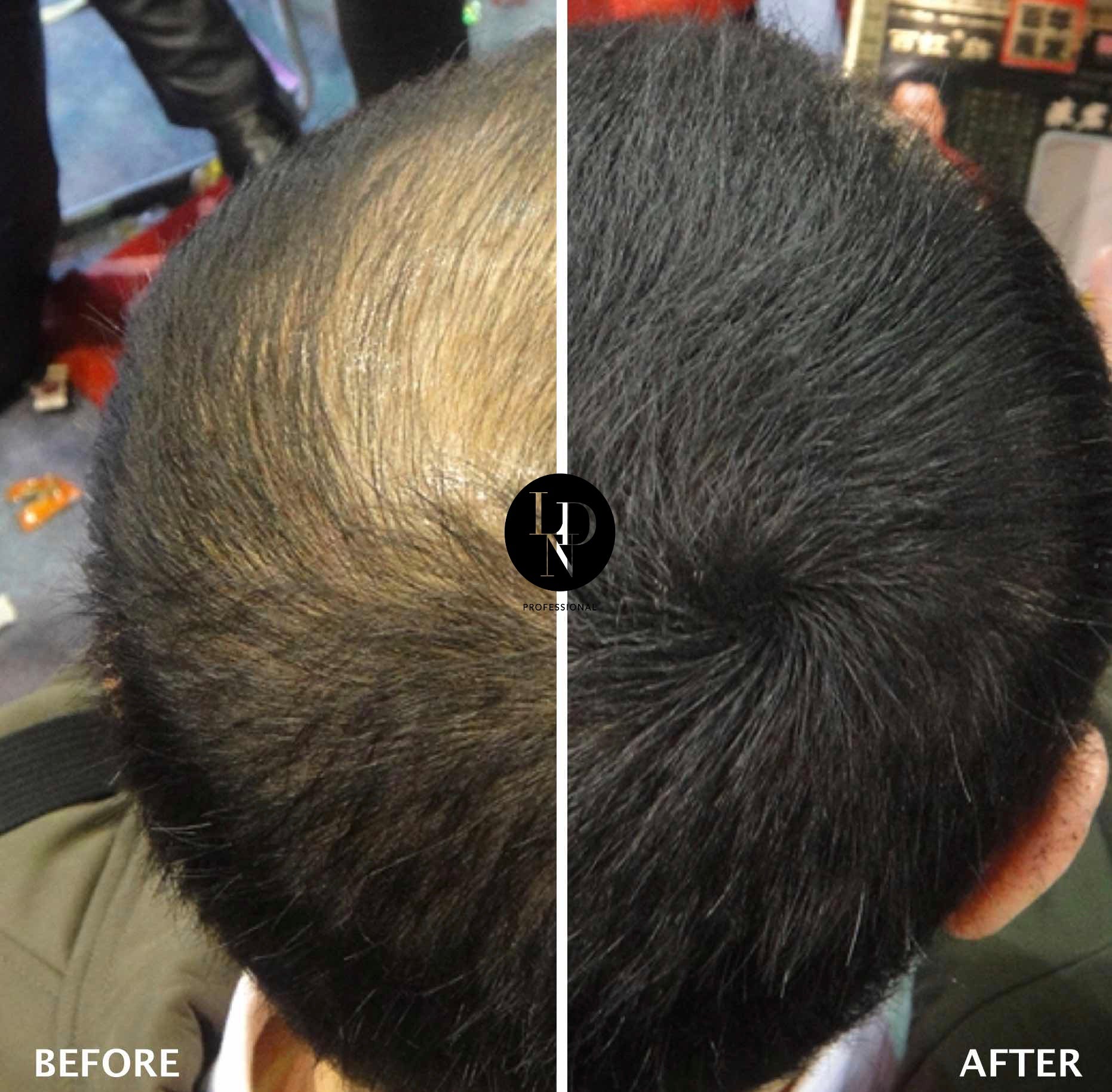 HAIR BUILDING FIBRES