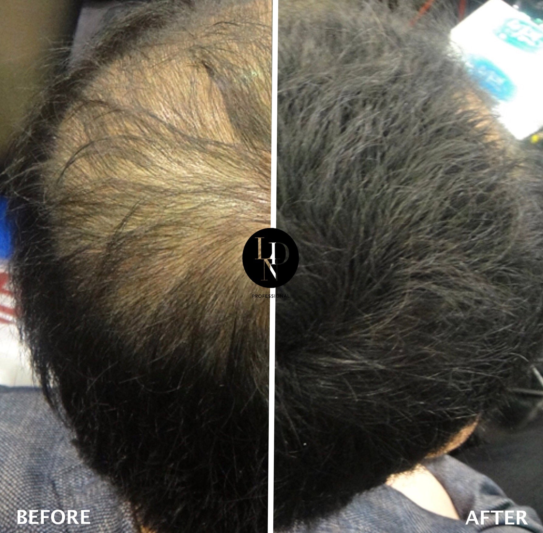 HAIR BUILDING FIBRES