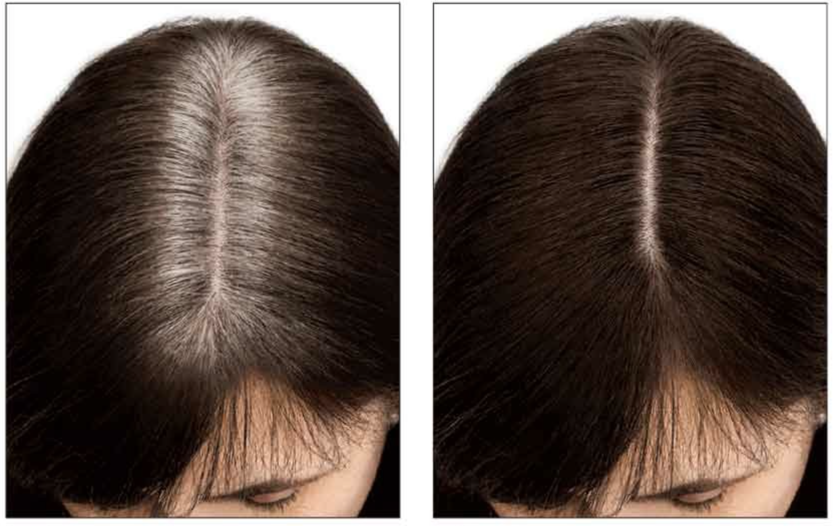 Root Cover Up