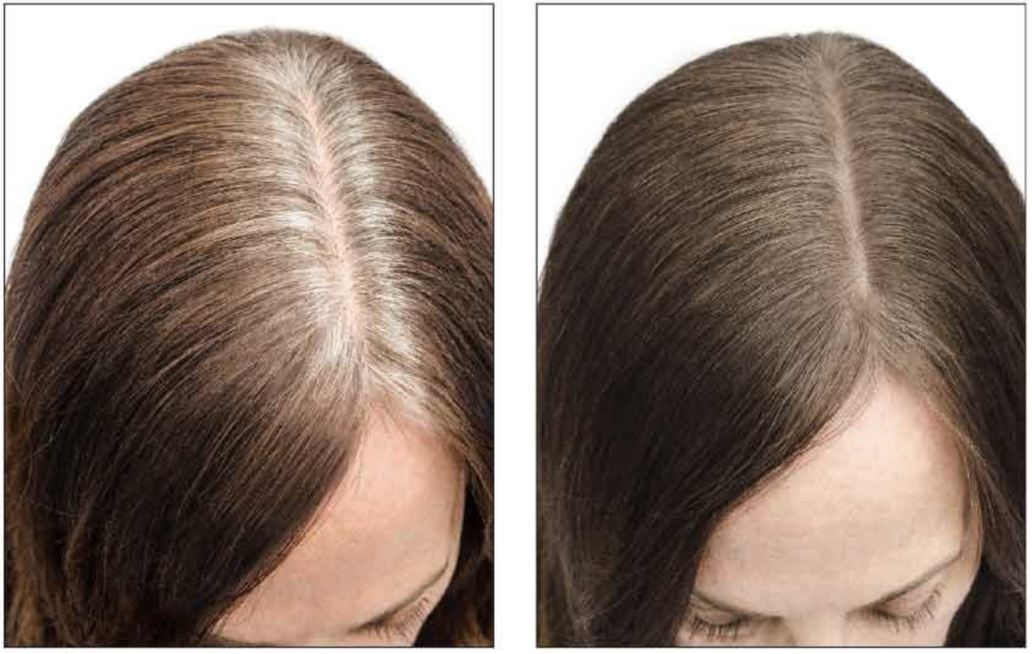 Root Cover Up - Medium Brown