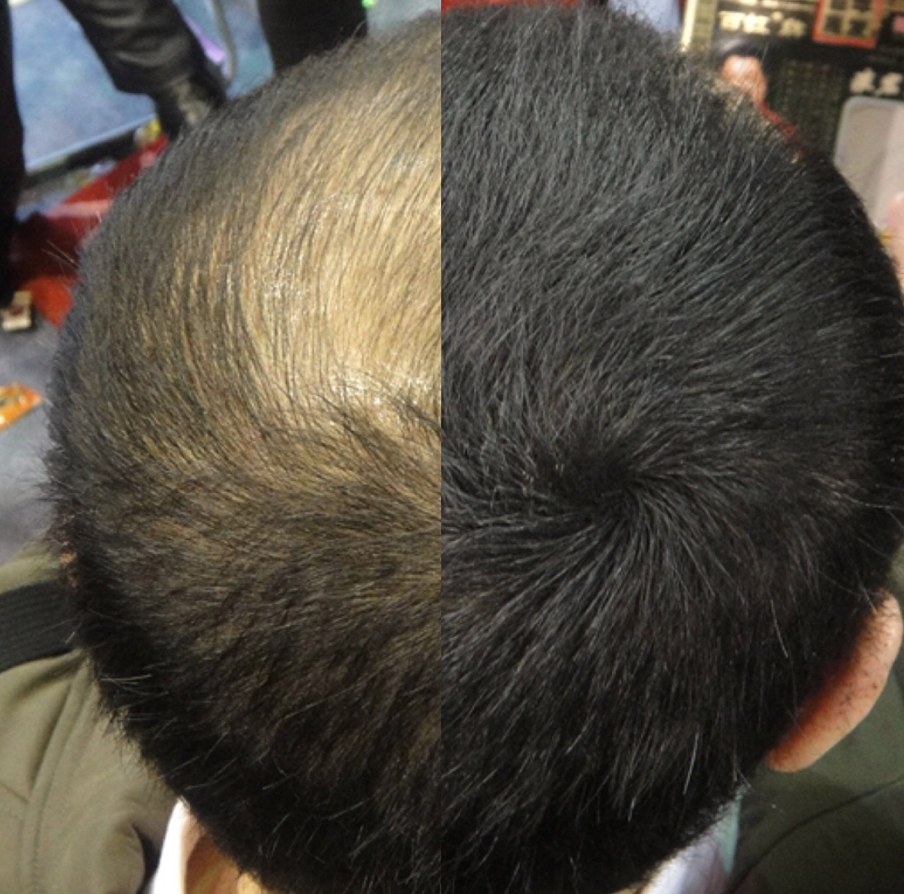 Hair Building Fibres - Dark Brown
