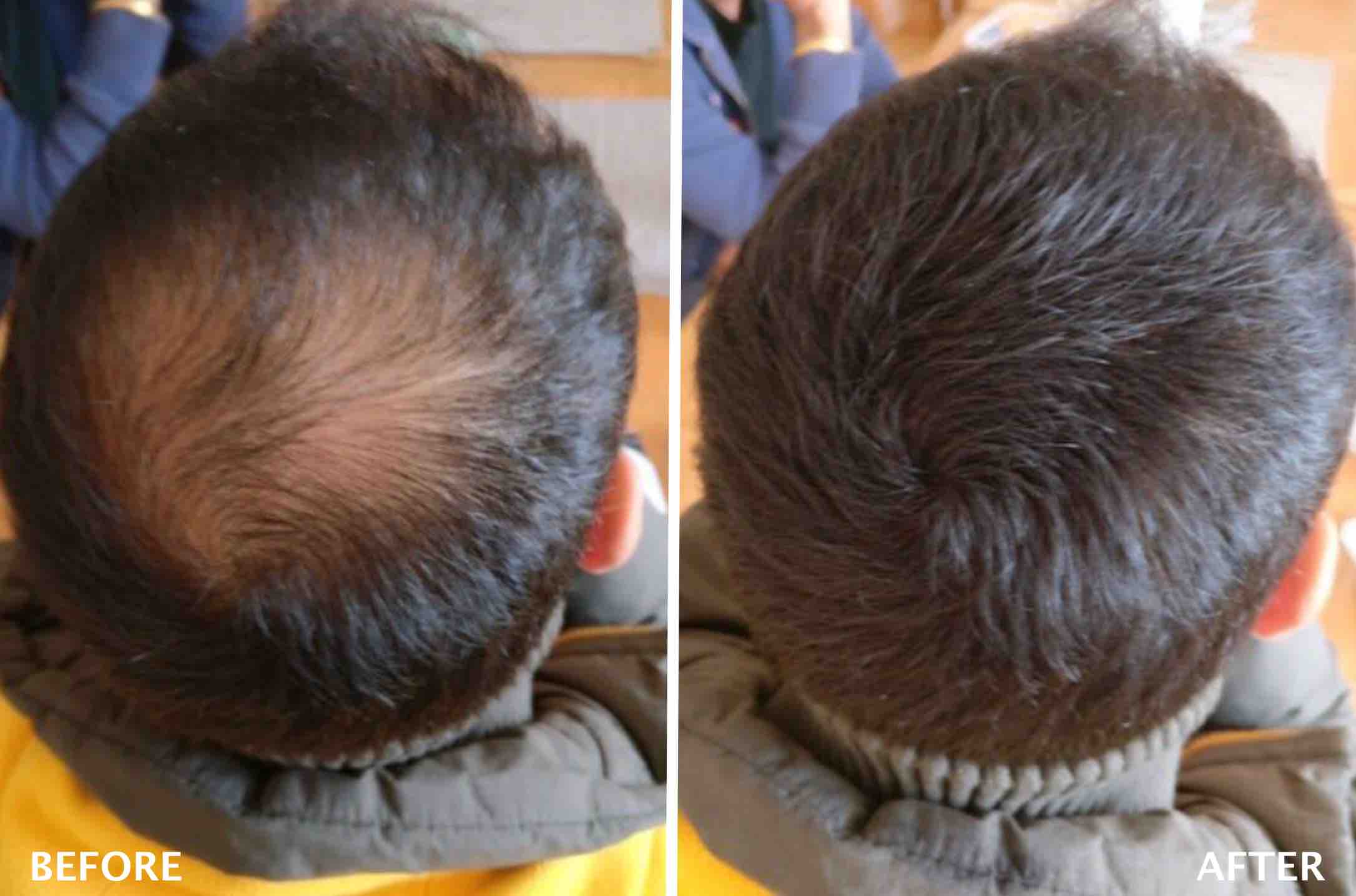 HAIR BUILDING FIBRES